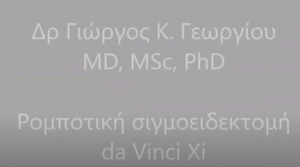 Ρομποτική σιγμοειδεκτομή da Vinci Xi