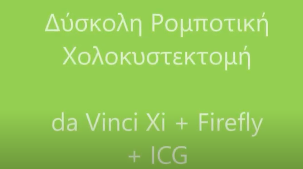 Ρομποτική χολοκυστεκτομή da Vinci Xi + Firefly + ICG